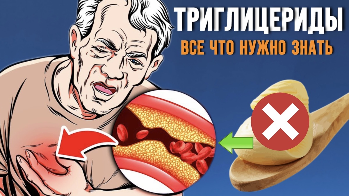 Роль триглицеридов в атерогенезе