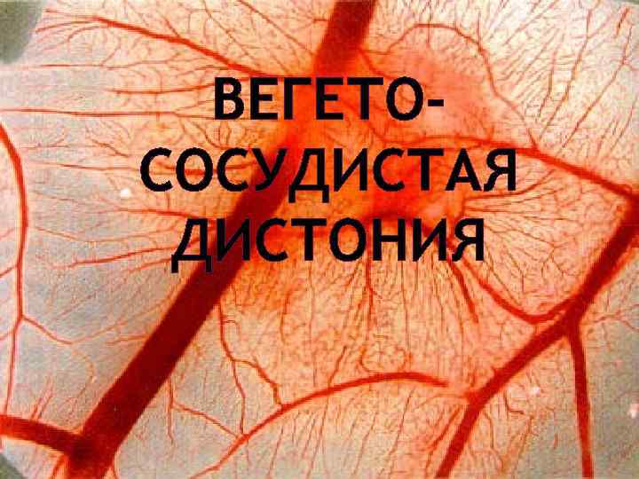 ВСД=СВД
