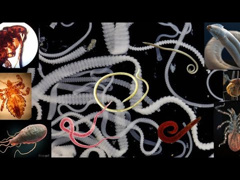 паразиты человека